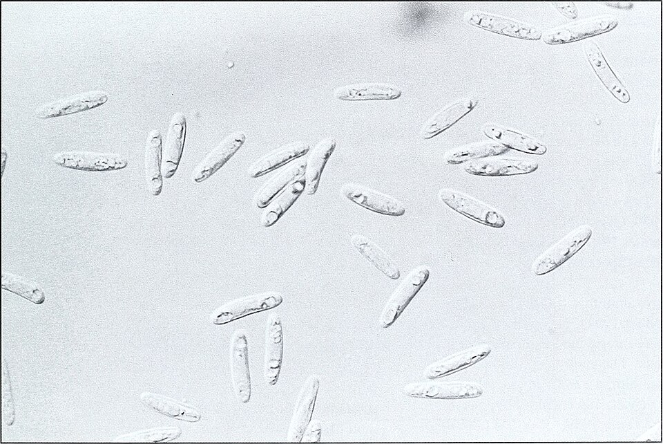 File:Blind seed disease (1567) (20385785315).jpg